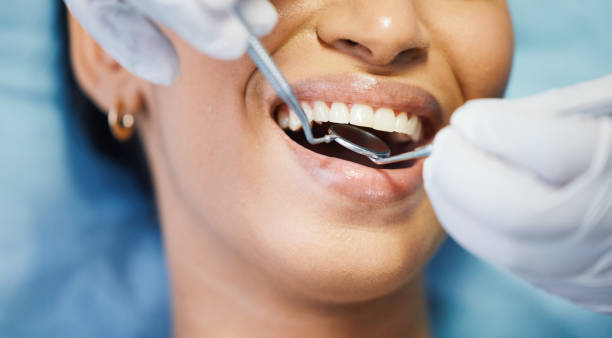 Best Lost Filling or Crown Replacement in Petersburg, IN