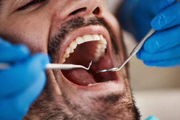 Best Walk-In Emergency Dental Services in Petersburg, IN