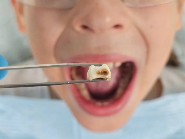 Best Weekend Emergency Dental Services in Petersburg, IN